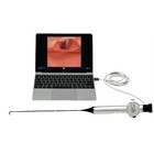 Reusable Rhinolaryngoscope For Laptop Connection 2 2mm-4 3mm  Hd Camera Optional