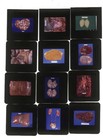 Lot Of 1 000 Vintage Medical Slides Organs Liver Disease Tumors Heart Brain