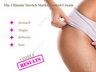 Gernetic Anti-stries Cream 150ml - Stretch Mark Prevention   Treatment