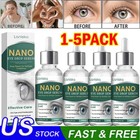 5x Eye Drops Serum  Natural Lubricant Eye Drops For Dry Eye Presbyopia  New Usa 