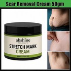 Best Scar Removal-cream For Old-scars Stretch Mark Removal Cream For Men   Women