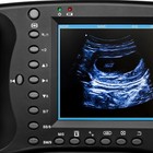 Portable Ultrasound Machine For Pregnancy - Digital Sonogram Machine With 3 5 Mh
