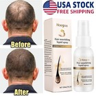 30ml Fast Hair Growth Dense Regrowth Ginger Serum Oil Anti-loss Treatment Spray