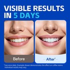 Persmax Teeth Whitening Strips     Professional Dentist Approved  Gum-safe Form   