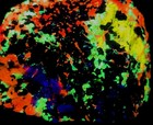 A   Sw Uv Fluorescent Esperite Hardystonite Willemite   Calcite Franklin Nj