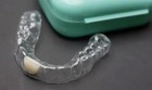 Retainer With Teeth  Affordable Way To Fill In Your Smile  With 1-3 Teeth Added 