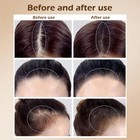 Hair Loss Concealer For Thinning Hair Balding Gray Hair Fibers 0 12 Ounce