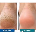 60  Urea Foot Cream Salicylic Acid Callus Remover Cracked Heel Repair Balm