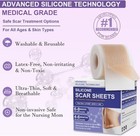 Silicone Scar Sheets Advanced Medical Silicone Scar Tape Pro 1 6 x 60 roll-1 5m 