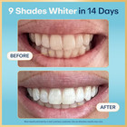 Teeth Whitening Strips - 21 Treatments  3 Months  - Peroxide Free - Enamel Safe