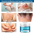 Roycederm Antifungal Cream  Athletes Foot Treatment Cream  Jock Itch Cream  2029