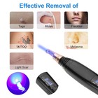 1pcs Brand New Laser Facial Skin Care Pen Tattoo Removal Machine-blue red Light
