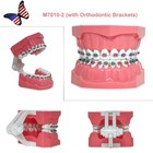 Us Dental Overdenture implant orthodontic Typodont Ortho Training Teaching Model