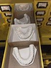 Lot Of 104 Dental Oddity Plaster Real Tooth Teeth Molds Dentist Cast Impressions