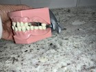 Columbia Dentoform Vintage Dental Teaching Model Teeth New York 862