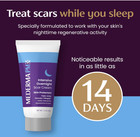 Mederma Pm Intensive Overnight Scar Cream 1oz   Reduces Scars While You Sleep