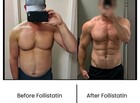 Follistatin  Supplement 10 Mg Vial  Myostatin Inhibitor For Lean Muscle Growth