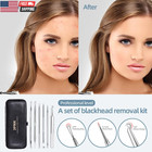 Blackhead Remover Comedone Extractor Acne Removal Kit  
