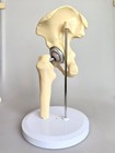 Size Hip Joint Replacement Medical Anatomical Skeleton Model Artificial 1 1