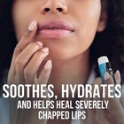 Chapstick Bulk Medicated Lip Balm 12-pack     External Analgesic Skin Protectan   