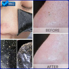 Deep Cleansing Pore Blackhead Remover Strips Acne Mask Face Peel Off Sticker
