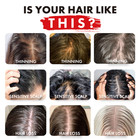 Alfheim Hair Care Set Shampoo Conditioner Hair Treatment Kit Repair Strengthen