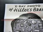 1944 Ww2 Usa America Cartoon Comic X-ray Insane Brain War Propaganda Poster C65