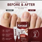 Kerasal Fungal Nail Renewal Nail Repair Cream  0 33 Fl Oz  10 Ml 