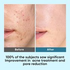 Elvira Korean Skincare Anti-aging   Glycolic Acid Exfoliating Facial Pads With 1
