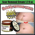Scar Repair Cream 50g   Anti Stretch Mark   Scar Removal Treatment