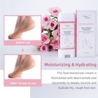 Foot Moisturizer Cream For Dry Cracked Heels And Feet Hydrate Rough Skin