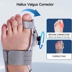 Treatmedy Bunion Toe Fix Valgus Corrector Big Toe Straightener For Men   Women