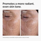 The Ordinary The Ordinary Glycolic Acid 7  Exfoliating Toner  Brightening And Sm
