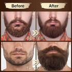 Beard Kit For Men Grooming   Care Set W 2 Pack Beard Serum  Wash  Oil  Balm  Com