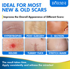 Best Scar Removal Cream Skin Care For Scars Reduce Surgery Acne Stretch Marks