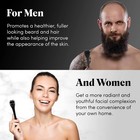 540 Microneedle Derma Roller 0 2mm 0 3mm Skin Face Beard Hair Growth Scalp Tool