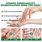 Ginger Nail Treatment Nail Care  Nail Growth Oil For Cuticle Nourishment