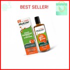 Medicasp Coal Tar Anti-dandruff Shampoo  Alleviates Symptoms From 1st Wash  Trea