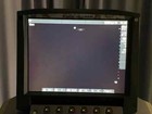 Sonosite Micromaxx P17 5-1 Mhz Transducer Phased Array Probe - Ref  P06073-13