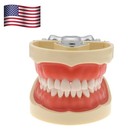 Kilgore Nissin 200 Type Dental Mounting Pole Typodont Model 32pc Removable Teeth