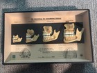 Medical Wax Anatomical Representation Of Teeth From Newborn To Adult