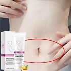 3 Pcs Set Rtopr Mango Remove Pregnancy Scars Cream Stretch Marks Treatment Cream