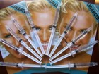 45  Peroxide Gel Teeth Whitening Tooth Whitener Bleach 10 Syringes Dental Refill