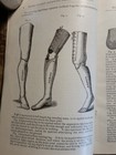 C1881 Mark s Patent Artificial Limbs Catalog India Rubber Hands   Feet New York