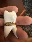 Limoges Porcelain Tooth-shaped Trinket Box With Gold Tone Band
