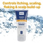 Mg217 Psoriasis Shampoo With Coal Tar  Therapeutic Scalp Treatment 8floz