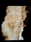 Xl Mind Blowing Birdseye Maple Burl Wood Blank  Turning   Epoxy stabilizing Wood