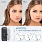Jpnk Blackhead Remover Comedone Extractor Acne Removal Kit  