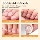 12pcs Cuticle Oil Pen Set nail Moisturizing Cuticle Oil Enriched With Vitamin E