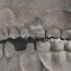Antique Dental Tooth Mold Dento-form Columbia Dental X-ray Corp Medical Oddity 